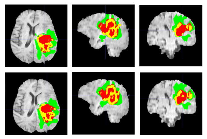 Medical Imaging Intelligence - Neuronics